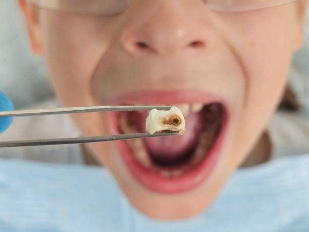 Best Emergency Dental Services for Seniors in Georgetown, CO