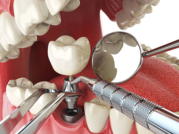 Best Emergency Dental Services for Seniors in Georgetown, CO